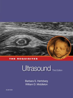 cover image of Ultrasound